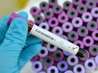 कोरोना वायरस (Coronavirus symptoms- COVID-19)