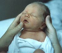 Emily at birth