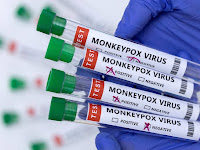 Monkeypox: WHO declares global emergency over.