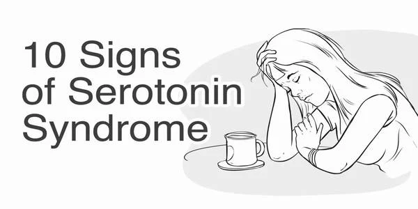 10 Signs of Serotonin Syndrome
