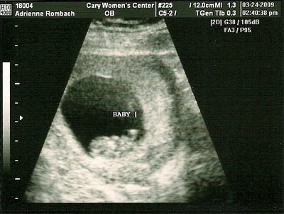 sonogram 5 weeks. Ultrasound pictures at 9 weeks