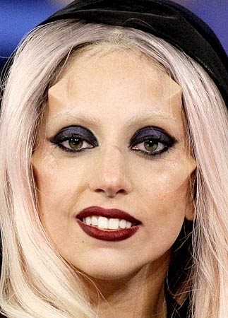 lady gaga horns implants. lady gaga horns surgery.