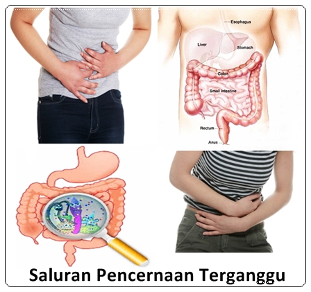 Pengobatan Herbal Untuk Saluran Pencernaan Terganggu