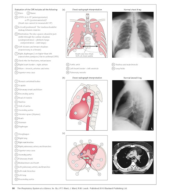 Chest Imaging And Bronchoscopy