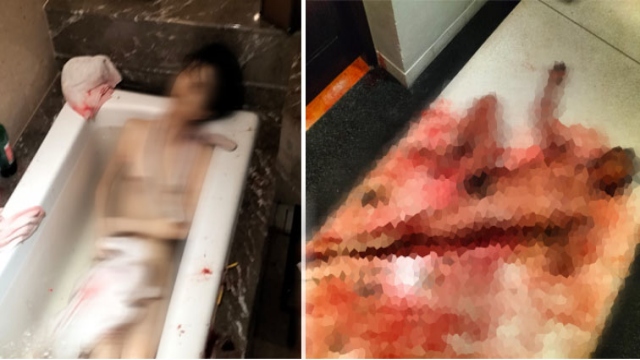 Geger! Pasangan Turis Asal China Ditemukan Tewas Telanjang dan Berlumuran Darah di Hotel Bali