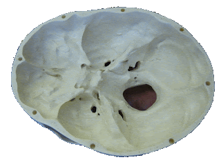 Image showing what the inside of the Somerton Man's skull would have looked like to Paul Lawson
