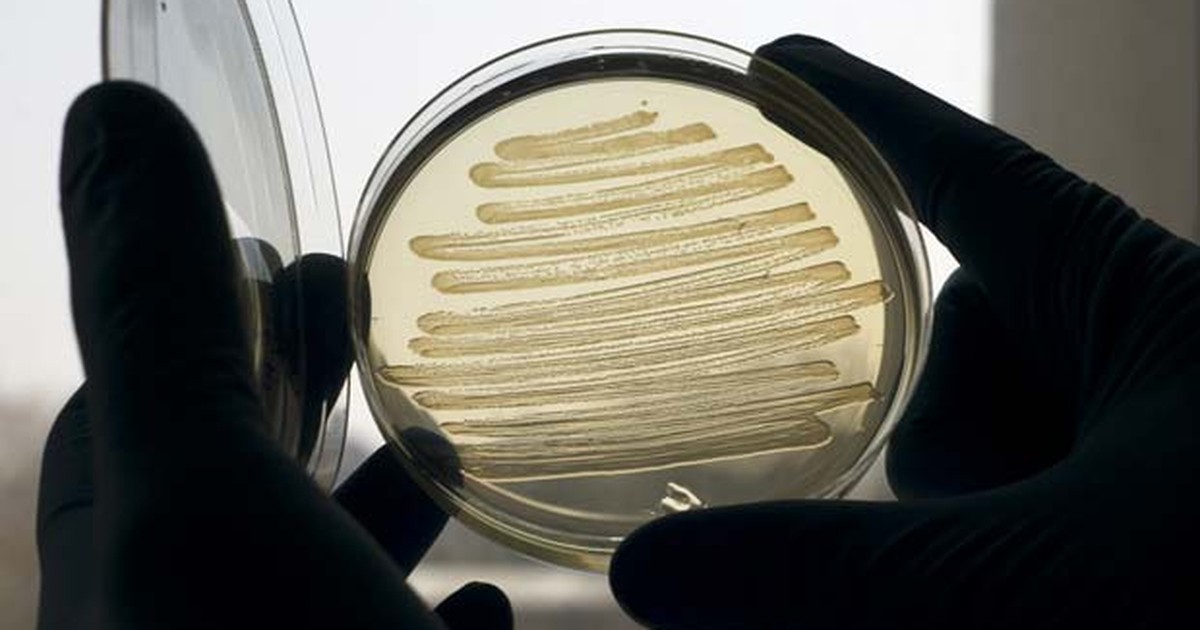 Materi Penanaman Bakteri Inokulasi  Pada Ilmu Mikrobiologi