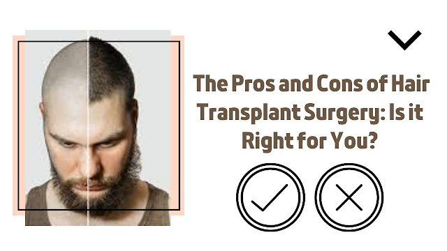 The Pros and Cons of Hair Transplant Surgery: Is it Right for You?