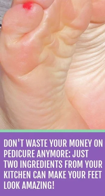 Don’t Waste Your Money on Pedicure Anymore: Just Two Ingredients from Your Kitchen Can Make Your Feet Look Amazing!