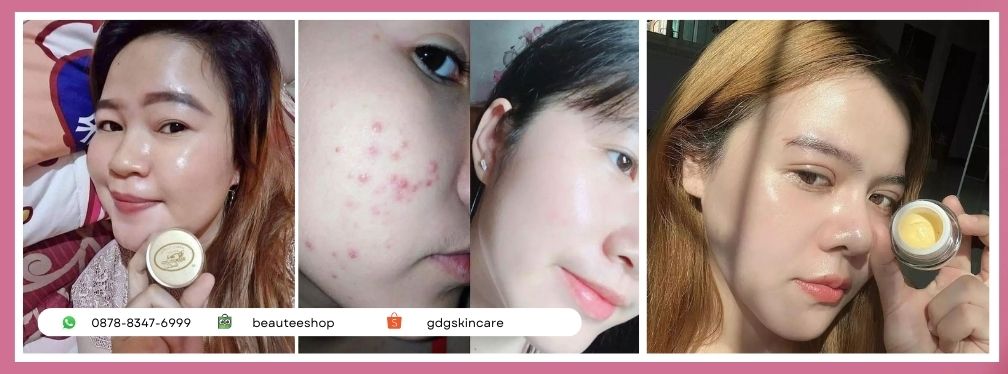 Tabita Skin Care Hasilnya Bagus