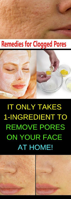 IT ONLY TAKES 1-INGREDIENT TO REMOVE PORES ON YOUR FACE AT HOME!