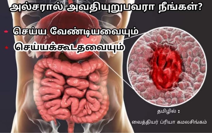 அல்சரால் அவதியுறுபவரா நீங்கள்..?? செய்ய வேண்டியவையும், செய்யக் கூடாதவையும் (விரிவான விளக்கம்)