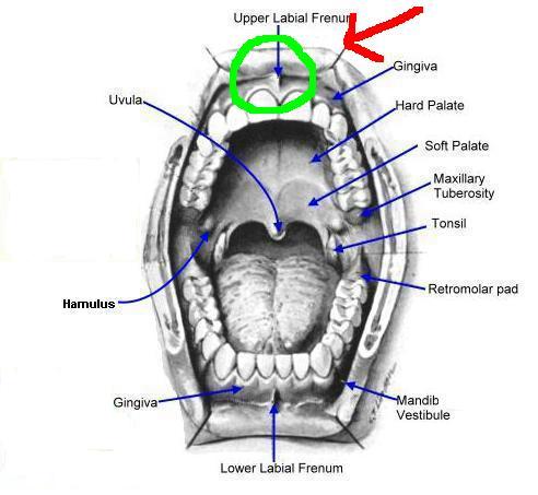 does your child have a low labial frenulum?