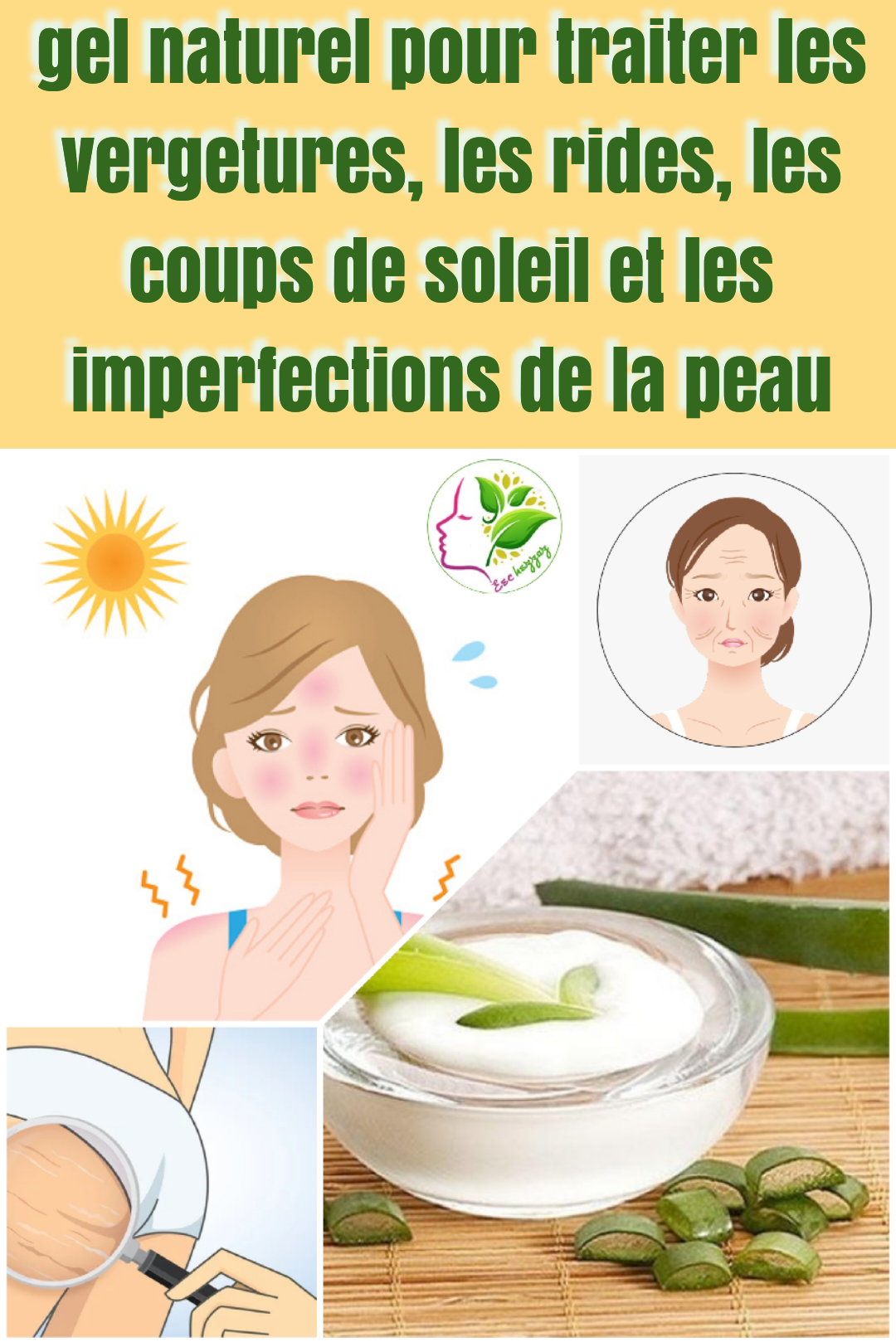 Recette gel naturel pour traiter les vergetures, les rides, les coups de soleil et les imperfections de la peau