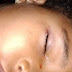 Menina de 3 anos tem olho mordido por rato enquanto dormia