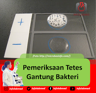 Pemeriksaan Tetes Gantung Bakteri