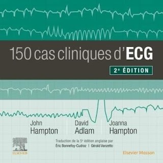 150 cas cliniques d'ECG 2023 (2ème édition) 