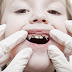Vì sao nên phòng ngừa sâu răng cho trẻ