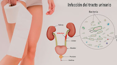 LAS INFECCIONES DEL TRACTO URINARIO