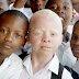 Dk Kamani apata mwarobaini wa mauaji ya walemevu wa ngozi albino