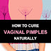 Vaginal Pimples: What Causes them and how to Treat them