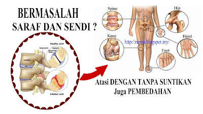 CARA TERBAIK MENGATASI MASALAH SENDI LUTUT, 