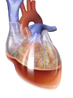 Tamponade Jantung efusi perikardial gambar picture cardiac tamponade pericardial effusion fluid cairan heart attack 