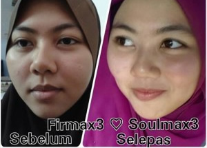 Jual Firmax3 Murah di Subang