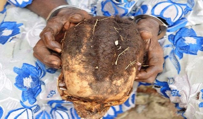 Graphic: Bricklayer Caught With Human Head In Osun, Says “Mistake Has No Master”