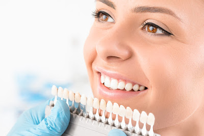 Bọc răng sứ có hết hô không? Cách điều trị hiệu quả nhất 1