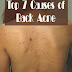 Top 7 Causes of Back Acne