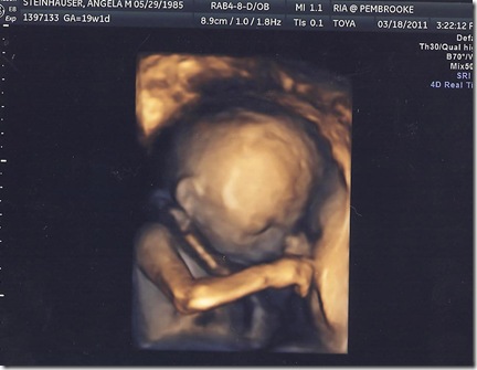 Baby #2 (4)GIRL