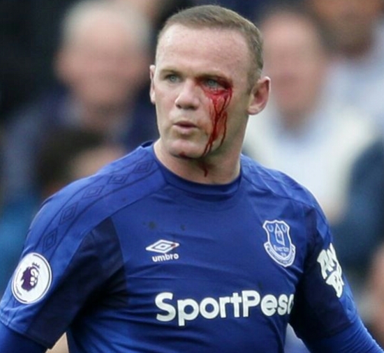 Wayne Rooney Surfers Eye Injury During Clash With Bournemouth (See Photos) 