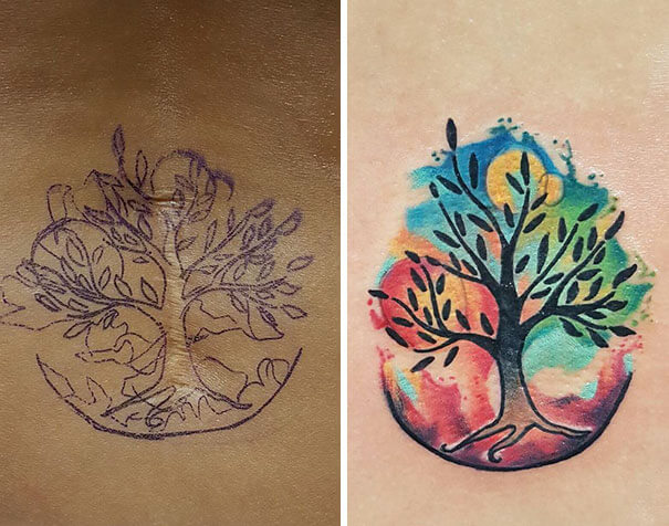 25 Beautiful Tattoos That Transformed Scars Into Artworks