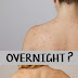 What Causes Shoulder Acne and How to Treat it?