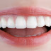 Cách làm răng đỡ hô không cần niềng