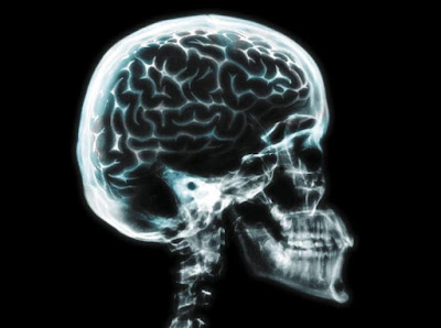 Representación de la radiografía de una calavera con el cerebro visible dentro