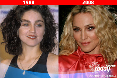 Madonna Had Some Plastic Surgery