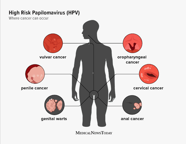 What is HPV