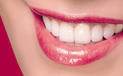 5 lợi ích khi tẩy trắng răng tự nhiên