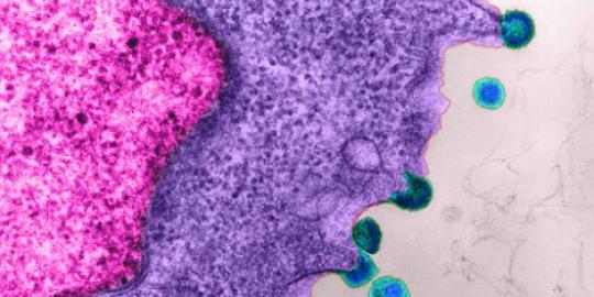 Ilmuwan Menemukan Cara Mengobati Virus Hiv [ www.BlogApaAja.com ]