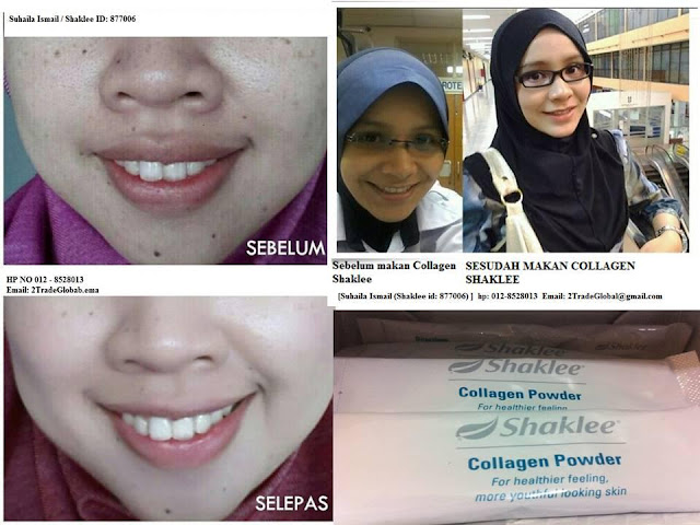 Testimoni Shaklee Collagen Powder