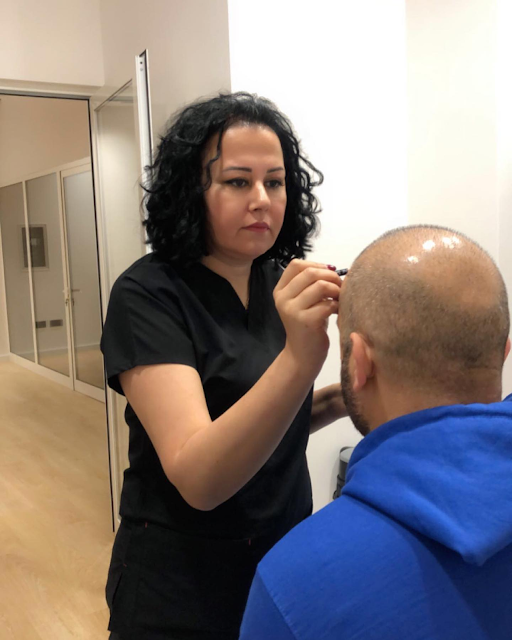 Dottoressa Azra, una delle dottoresse della clinica dedicata al Turismo medico Albania a Tirana con un'esperienza di oltre 15 anni nel campo del trapianto di capelli, disegnando la linea di attaccatura a un paziente italiano di 41 anni