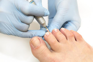 fungal-toenail-therapy