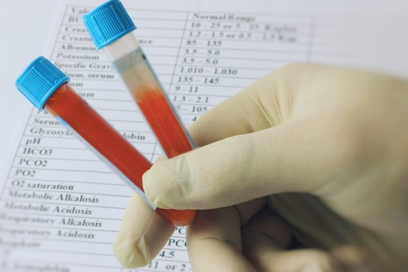 9 Things Your Blood Type Tells You About You