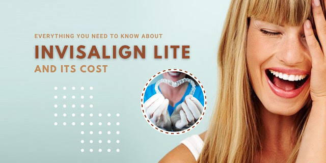 Everything You Need to Know About Invisalign Lite and Its Cost