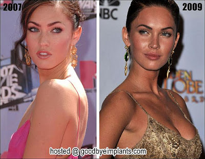 megan fox plastic surgery