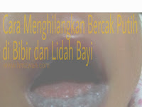 Cara Menghilangkan Bekas Jahitan Di Bibir