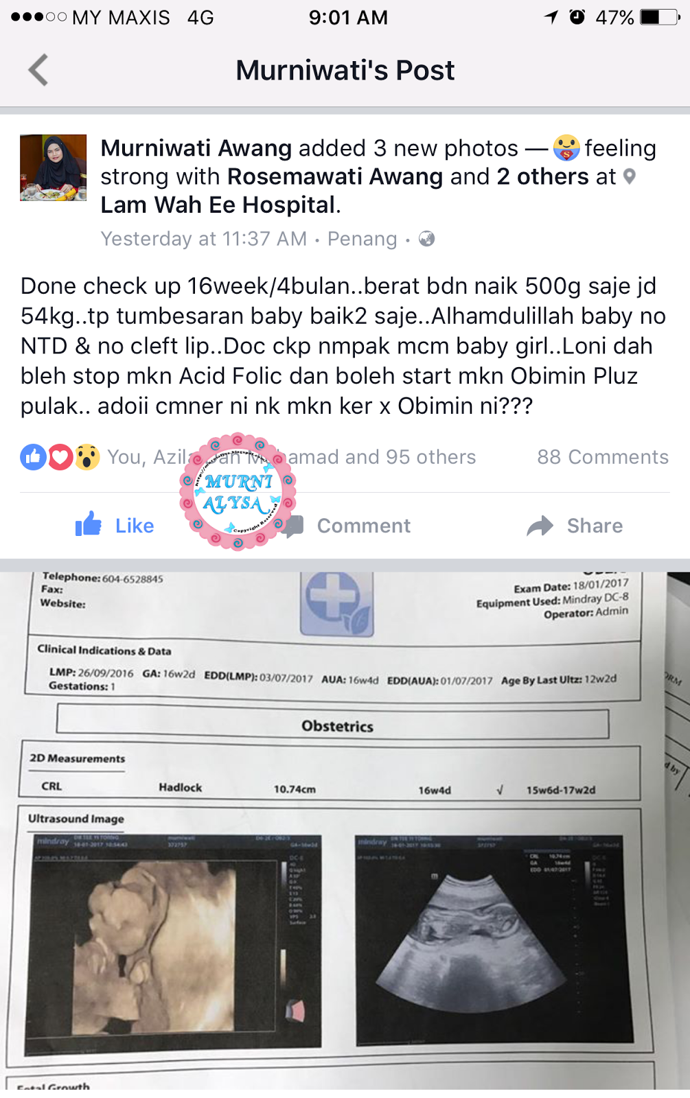 Hukum Share Gambar Scan Baby Dalam Perut  Coretan Murni Alysa