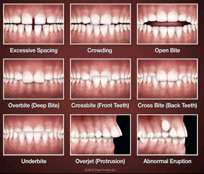 Eliminate many problems related to gums and teeth, clove tea